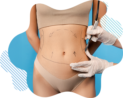 Abdominoplastia en Manta Ecuador - Cirugía de Abdomen Silueta Divina