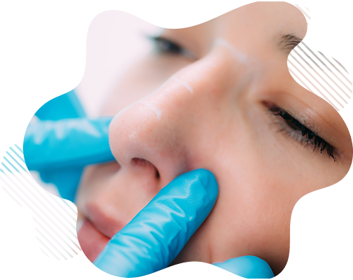 Rinoplastia en Manta Ecuador - Cirugía Nariz Silueta Divina